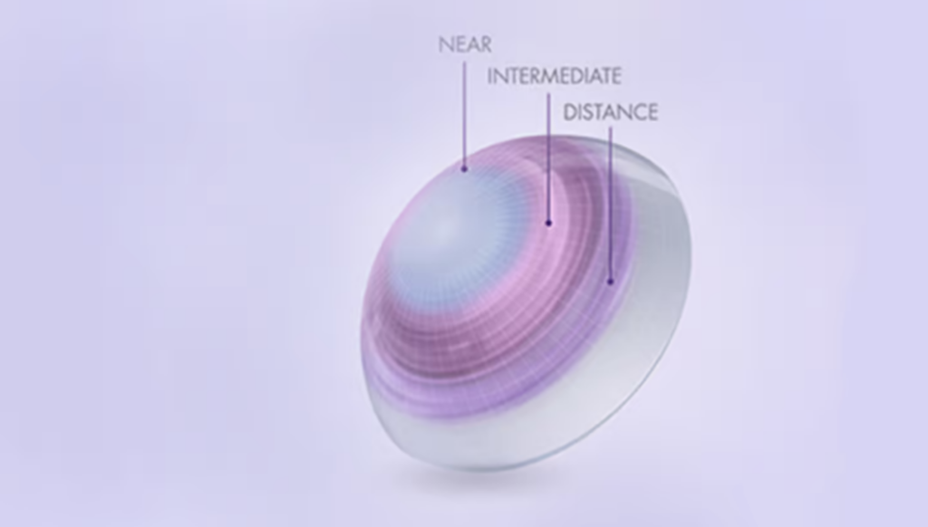 optometry-eyes-eyewear-eyeglasses-glasses-lenses-blue-light-filter-exposure-eye-fatigue-strain-dry-how-often-schedule-eye-exam-annual-comprehensive-cee-aee-optometrist-optical-illusions-eye-care-eyecare-oct-imaging-optical-coherence-tomography-octa-eye-disease-cataracts-glaucoma-diabetes-diabetic-retinopathy-macular-degeneration-drusen-blindness-vision-optometrist-eye-care-eyecare-risk-assessment-diabetic-eye-exam-a1c-retinal-screening-optos-optomap-fundus-eye-doctor-comanagement-lasik-consultation-refractive surgery--retinal-screening-fundus-photography-nevus-melanoma-eye-cancer-optomap-retinal-imaging-onjunctivitis-viral-bacterial-fungal-allergic-pink-eye-optometrists-vs-ophthalmologists-vs-opticians-lasik-evo-icl-refractive-surgery-upneeq-droopy-eyelids-lids-acquired-ptosis-eye-dilations-alcon-dailies-total-1-multifocal-acuvue-oasys-1-day-max-multifocal-presbyopia-reading-glasses-progressive-lenses-vuity